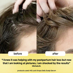LOCK DROPS ANTI-SHEDDING SCALP & HAIR SERUM