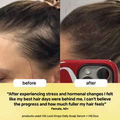LOCK-IN THICKER HAIR: 3-MONTH SUPPLY